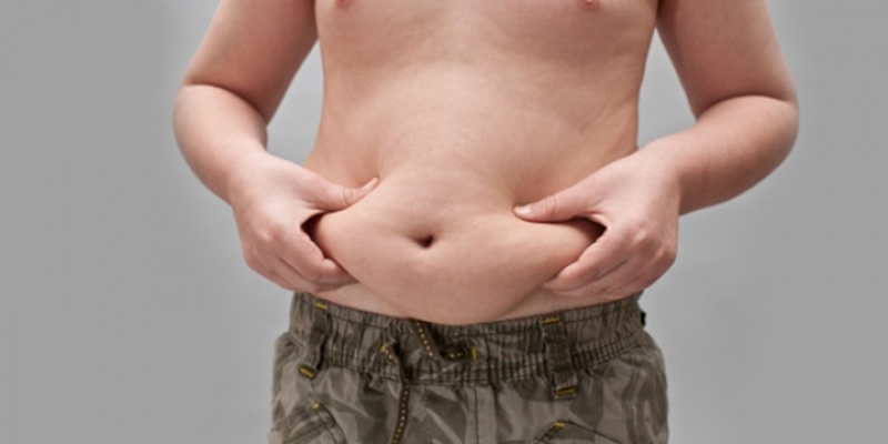 Abdominoplastia para Homem