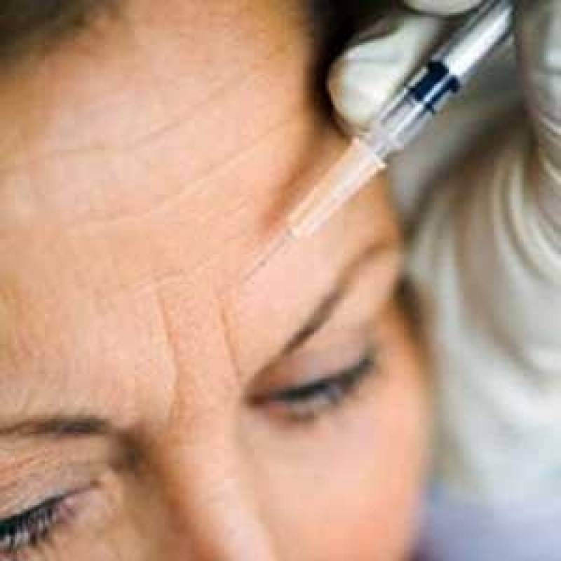 Aplicação de Botox na Glabela