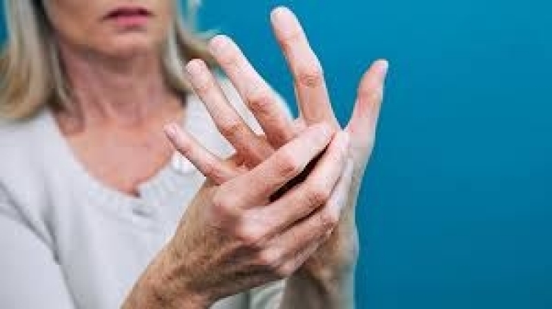 Artrite Reumatoide Exames
