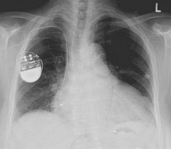 Cardiologista para Tratar Arritmia Cardíaca