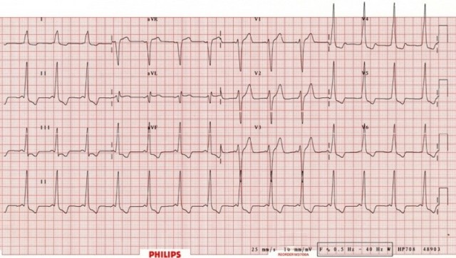 Cardiologista para Tratar Infarto