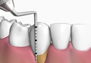 Centro de Especialidade Odontológica