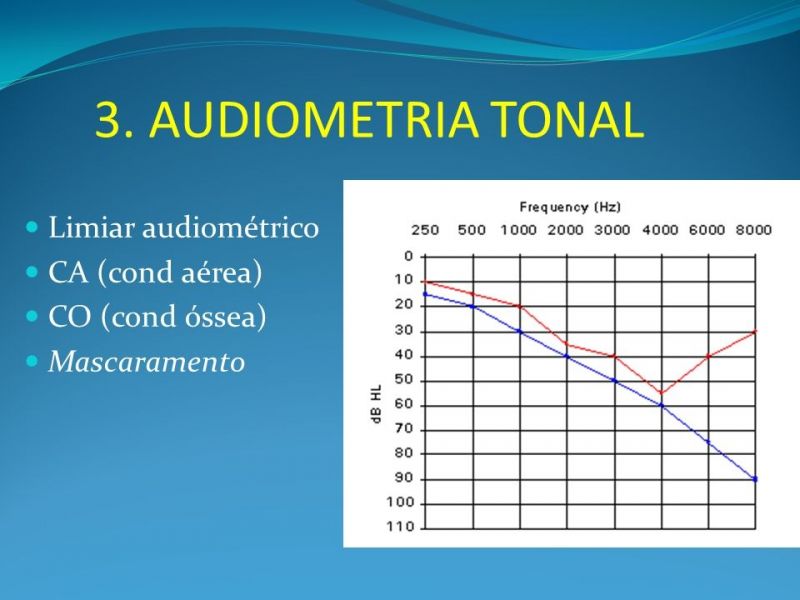 Centro de Exame Audiômetro