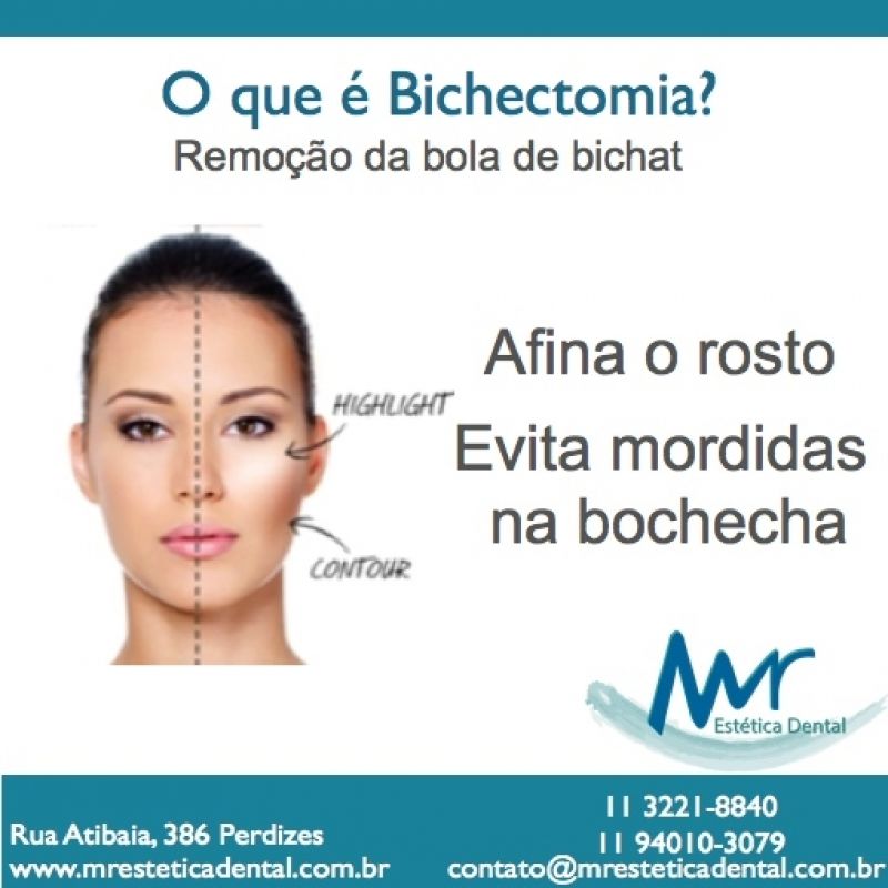 Cirurgia de Bichectomia