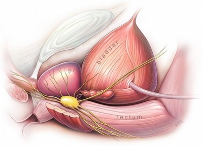 Cirurgia Urológica Robótica