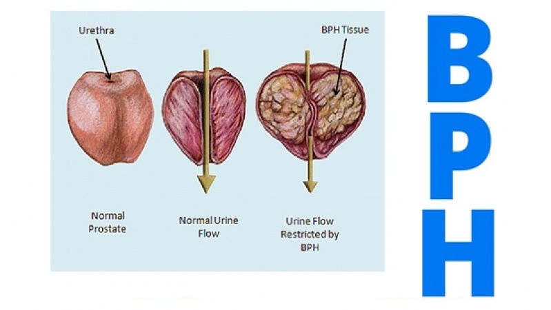 Cirurgia Urológica