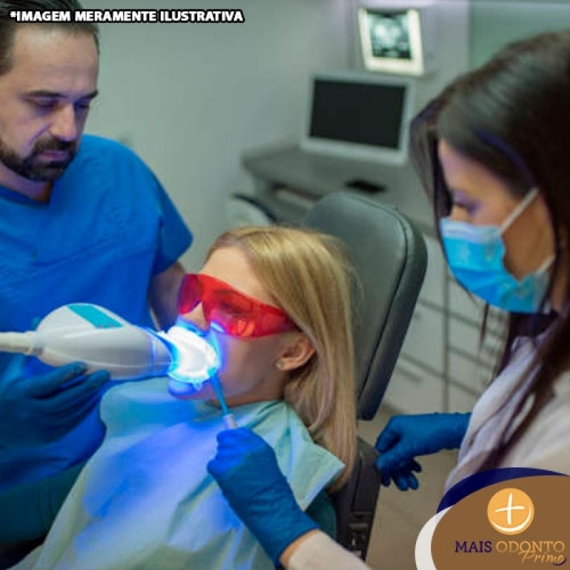 Clareamento Dental Instantâneo