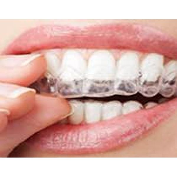 Clareamentos dos Dentes