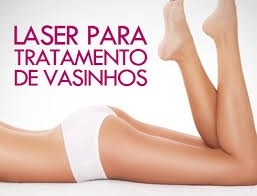 Clínica com Laser para Vasinhos