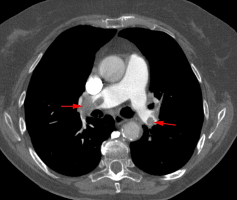 Clínica com Médico Pneumologista