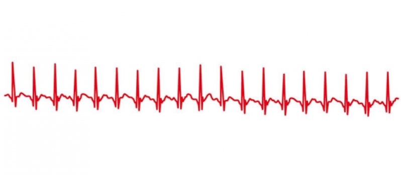 Clínica de Cardiologia para Tratar Miocardiopatia