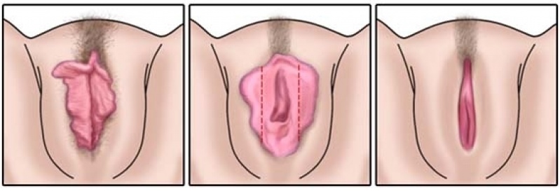 Clínica de Cirurgia Plástica em São Paulo