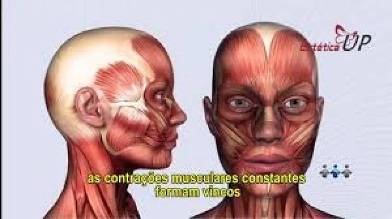 Clínica de Estética Up Preenchimento Acido Hialurônico