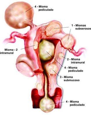 Clínica de Exames Ginecológicos