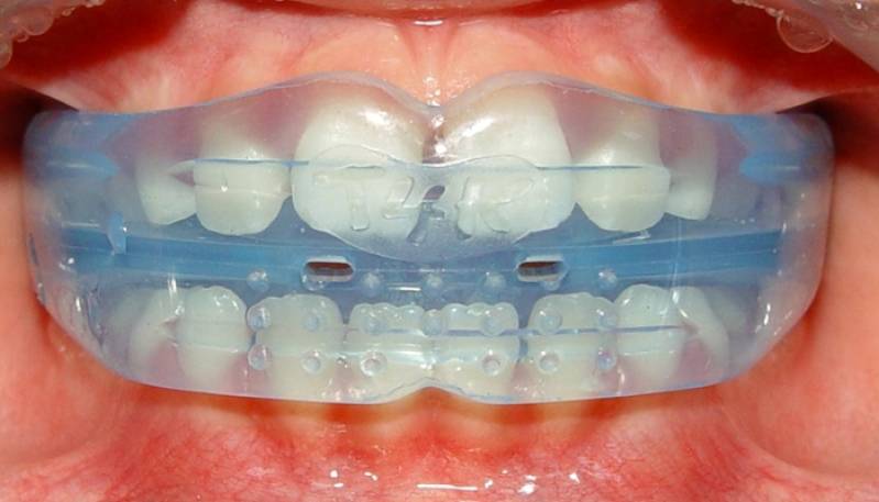 Clínica de Odontologia Laserterapia