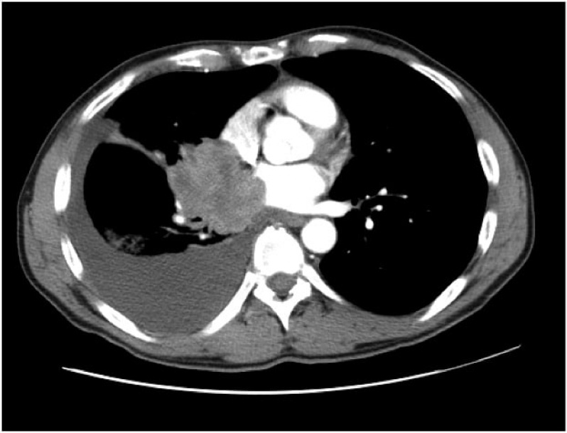 Clínica de Pneumologista para Tosse Seca