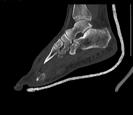 Clínica de Tomografia