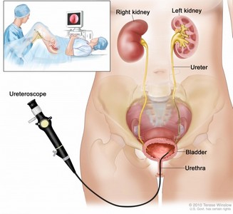 Clínica de Urologia para Tratar Câncer de Bexiga