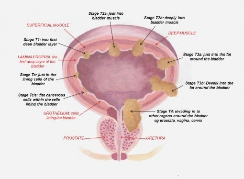 Clínica de Urologista Que Aceita Bradesco