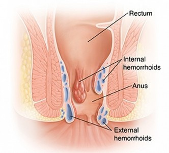 Clínica de Urologista Que Aceita Sulamérica