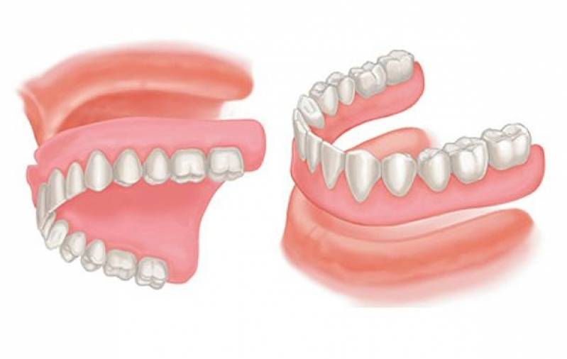 Clínica para Colocar Lente de Contato Dentária