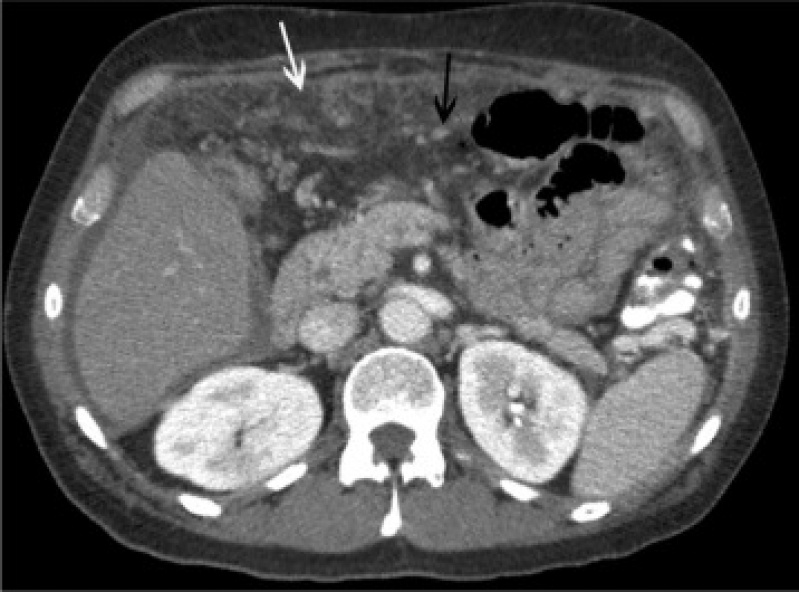 Clínica para Exames de Tomografia Abdominal