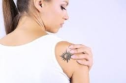 Clínica para Remover Tatuagem