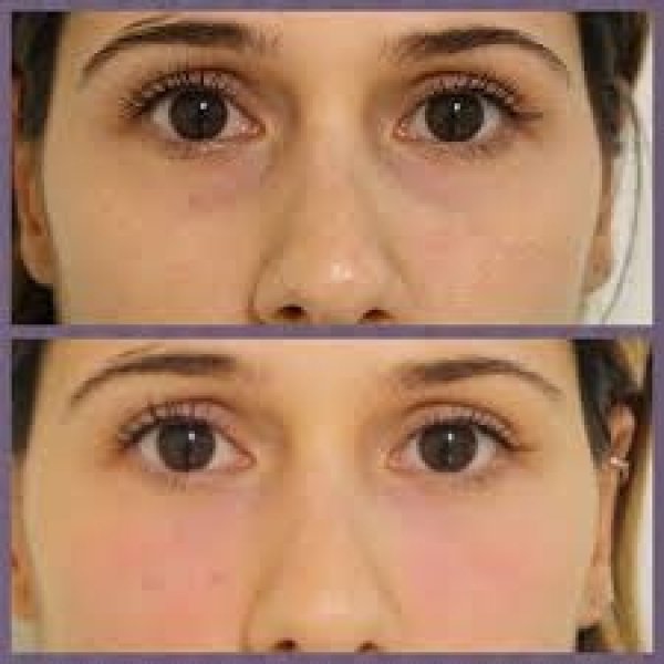 Clínica Preenchimento Facial