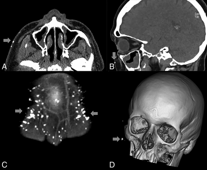 Clínicas para Exame de Tomografia da Pelve