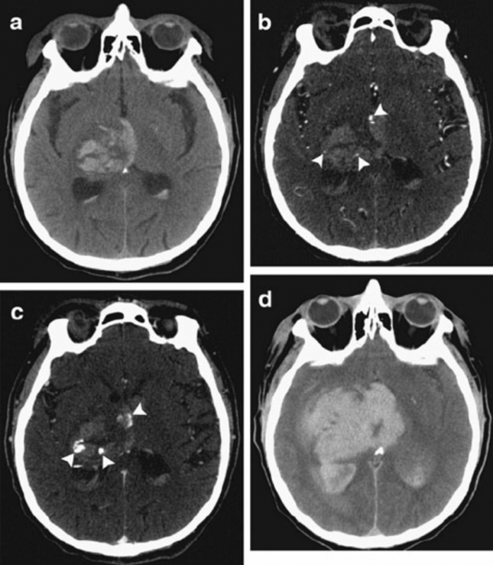 Clínicas para Exame de Tomografia do Crânio