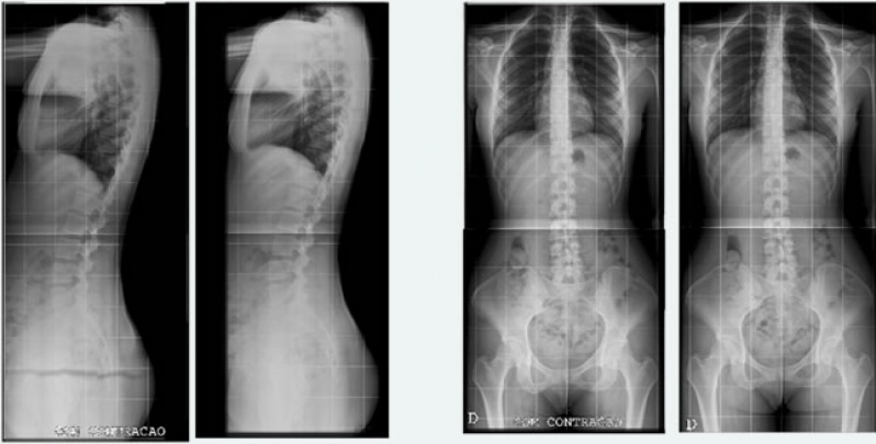 Clínicas para Exames de Tomografia