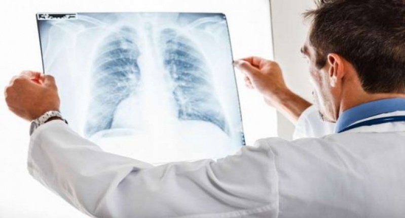 Consulta ao Pneumologista para Pneumonia