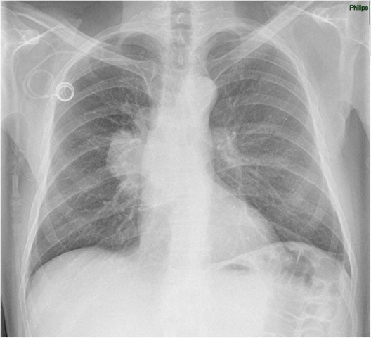 Consulta Particular ao Pneumologista