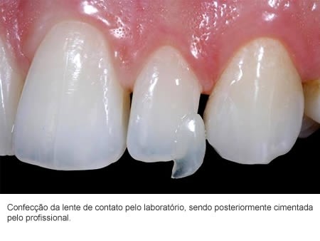 Dentista em Embu das Artes