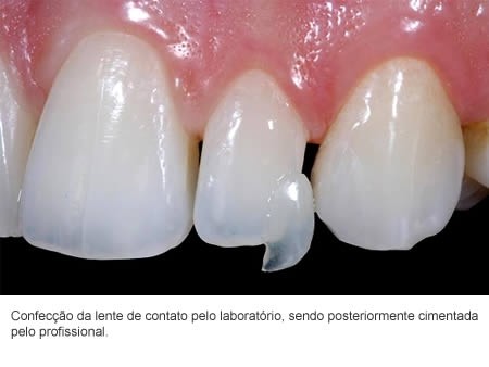 Dentista em Embu das Artes