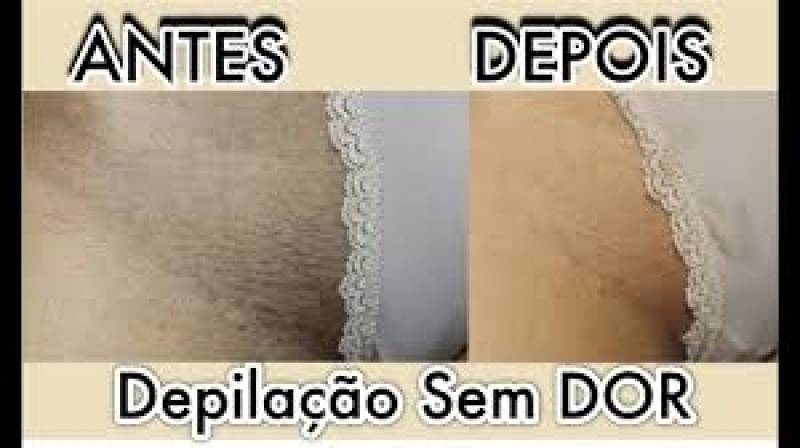 Depilação com Cera Quente na Virilha