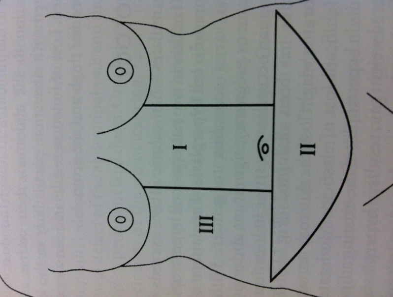 Dermolipectomia Abdominal com Lipo