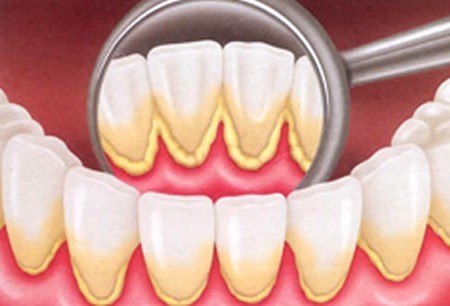 Diagnóstico em Periodontia