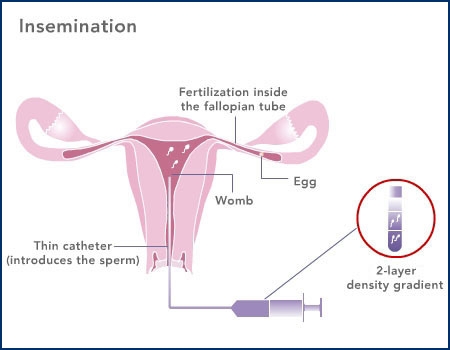 Diagnostico Pré Implantacional