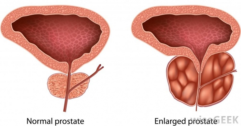 Especialista em Urologia para Mulheres