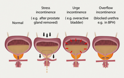 Especialista em Urologia Que Aceita One Health