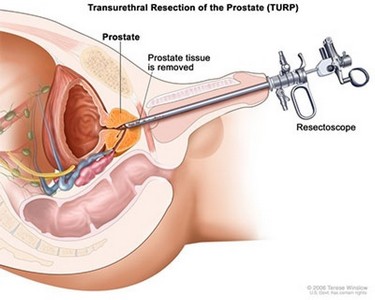 Especialista em Urologia