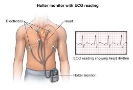 Exame Cardiológico Holter