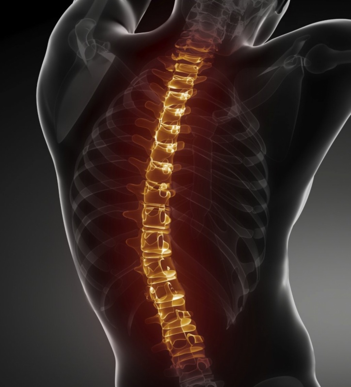 Exame de Ressonância Magnética da Coluna Cervical