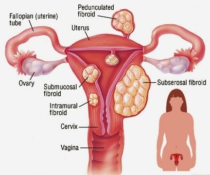 Exames Ginecológicos para Gestantes