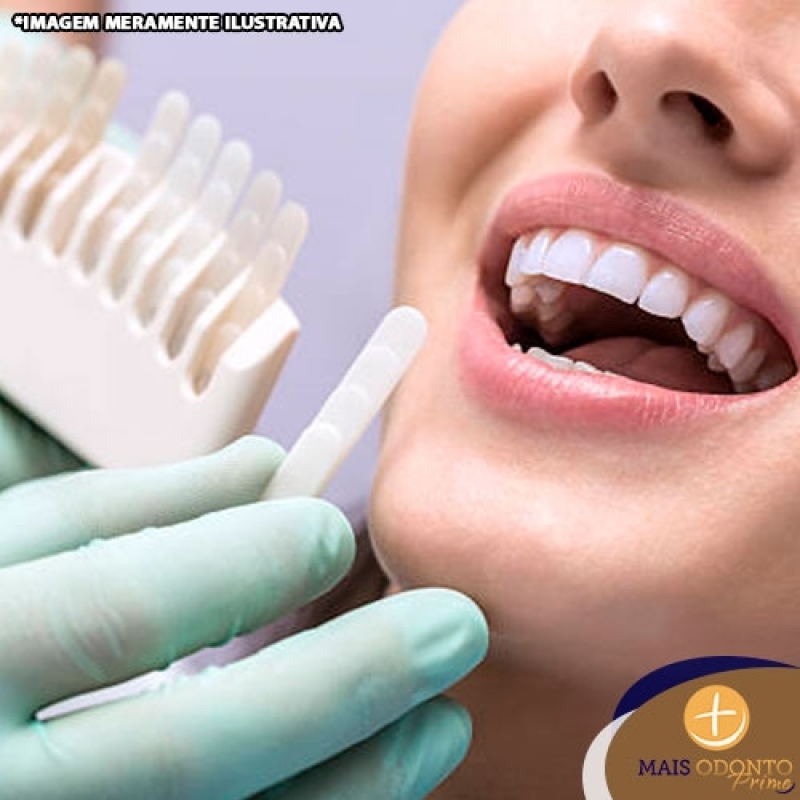 Faceta Dental