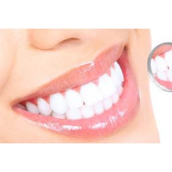 Fechamento de Diastema Resina Composta