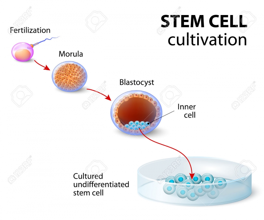 Fertilização In Vitro para Engravidar