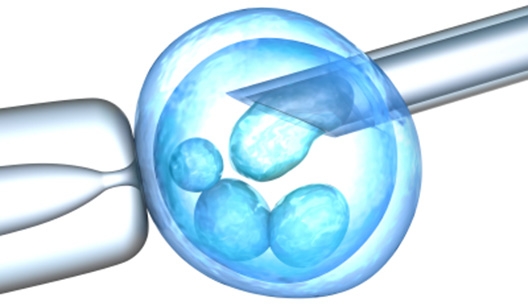 Fertilização In Vitro