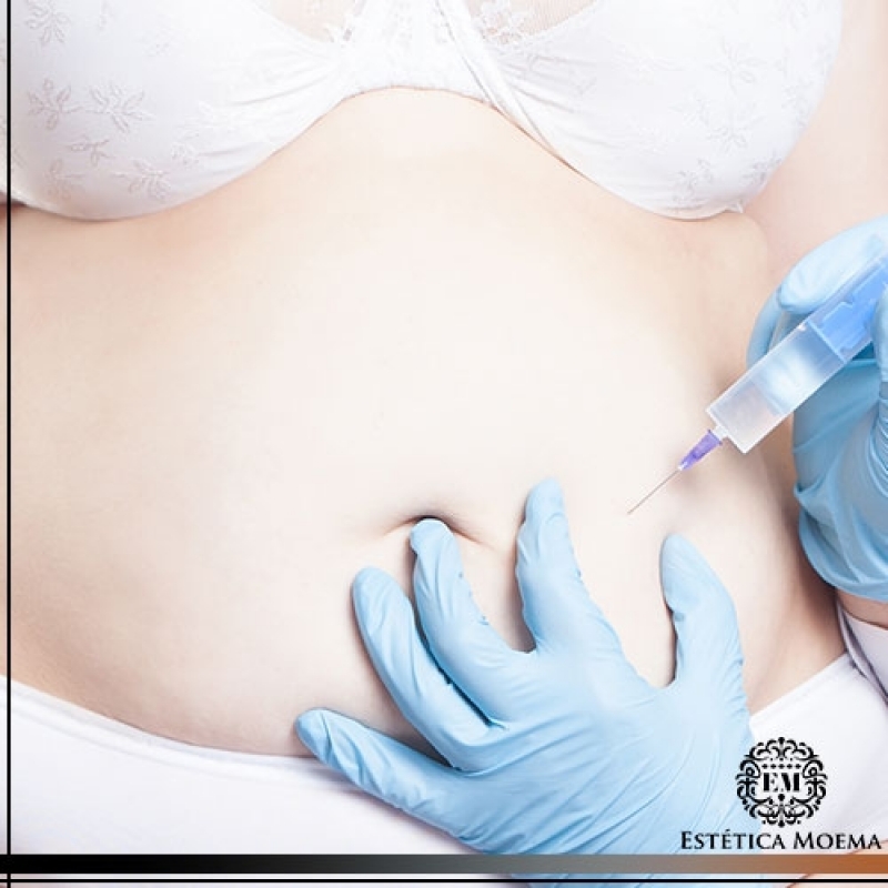 Intradermoterapia Abdômen